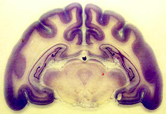 Coronal section of the cat forebrain