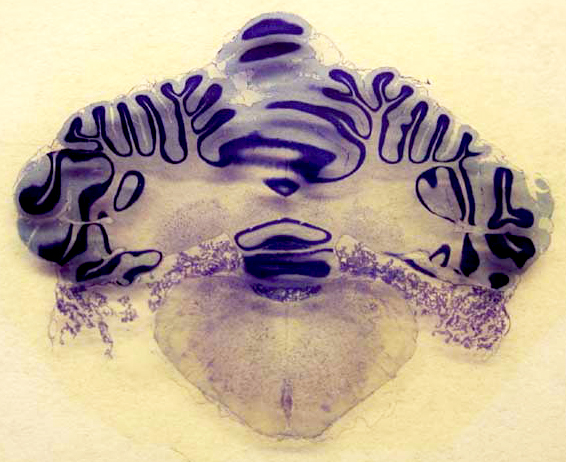Cross-section of a cat hindbrain