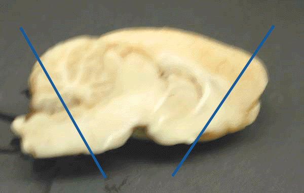 Midsagittal slice of rat brain