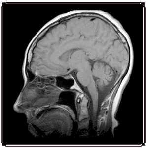 MRI image part 3.gif (45395 bytes)