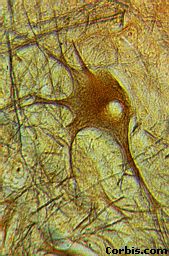 spiral cord neuron.jpg (18803 bytes)
