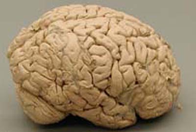 human brain image