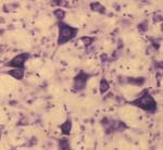 rat hindbrain high power