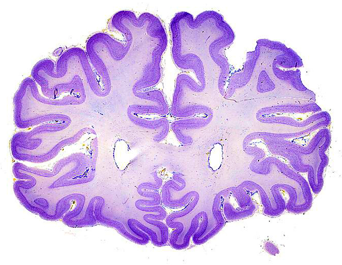 Coronal Section of the Human Forebrain