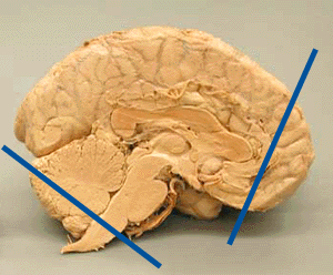 Midsagittal view of human brain