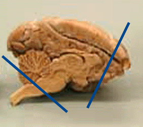 Midsagittal view of monkey brain
