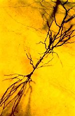 Magnified neuron