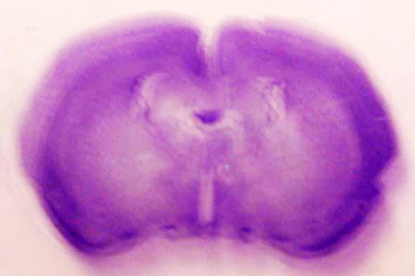 Cross-section of a rat forebrain
