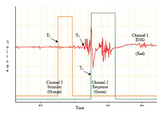 Latency Traces